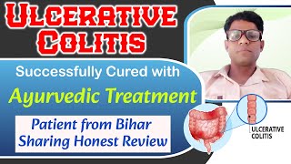 Ulcerative Colitis Ayurvedic Treatment Successfully Cured Patient From Bihar Sharing Honest Review [upl. by Layne506]