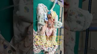 Nesting baby cutedoctor reels newborn newdoctor cutebaby kashmir India baby cute america [upl. by Thanasi]