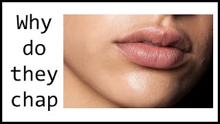 Why do lips become chapped [upl. by Corbie]