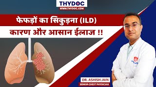 Fefdo Ka Sikudna Lung Fibrosis Treatment Lung Fibrosis Kya Hota Hai Dr Ashish Jain Jaipur [upl. by Seigel]