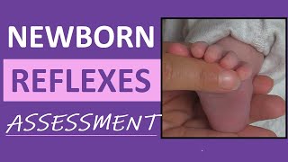 Newborn Reflexes Assessment Infant Nursing Pediatric NCLEX Review [upl. by Azyl]