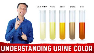 What Urine Color Indicates About Your Body – DrBerg [upl. by Negem]