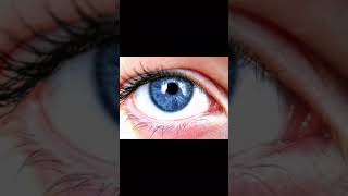 Polycoria is a rare eye condition where there are more than 1 pupil in the eye [upl. by Revned]