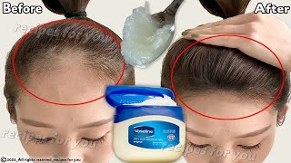 How to use Vaseline for double hair growth your hair will grow 3 times faster [upl. by Nuhsyar]