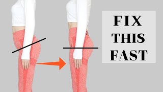 Eng Relieve Lower Back Pain amp Look Taller 8 MIN Exercise to Fix Anterior Pelvic Tilt FAST [upl. by Anerbes]