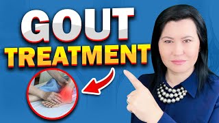 Effective Treatments for Gout The Ultimate Guide [upl. by Aihsirt]