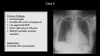 How to Interpret a Chest XRay Lesson 10  Self Assessment Part 1 [upl. by Humpage]