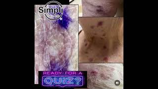 Dermatology Quiz Time [upl. by Klimesh]