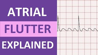 Atrial Flutter ECG Causes Treatment Nursing NCLEX ACLS Heart Rhythm Explained [upl. by Ystap199]