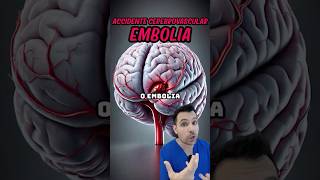 ¿Que es un accidente cerebrovascular 🧠 consejosparaunavidasaludable [upl. by Yzmar380]