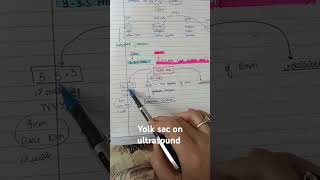 OBSTETRIC ULTRASOUND BASICS PART 1 MRCOG1 mrcog discussyourstudyoptionwithus [upl. by Shelby331]