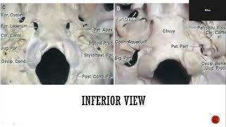 Anatomy of Jugular Foramen [upl. by Leach165]