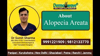 Alopecia Areata Signs Symptoms Causes amp Hair Regrowth Treatments  Alopecia Treatment  Dermawave [upl. by Annocahs]