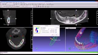 guidemia express dual scan mp4 [upl. by Coates425]