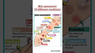 Skin assessment  viralvideo erythema vitiligo eczema scar [upl. by Isidora]