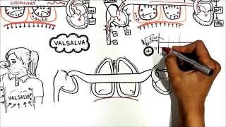 Cardiovascular changes with ventilation USMLE step 1 [upl. by Jimmie]