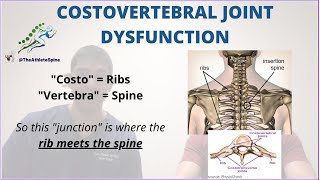 What is Costovertebral Joint Dysfunction A look into Mike Trouts Rare Back Injury [upl. by Whall]