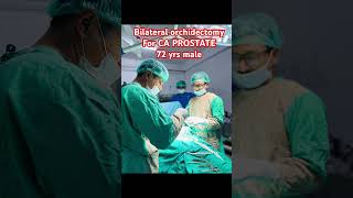 Bilateral orchidectomy  carcinoma prostate  dr bijay [upl. by Clerissa398]