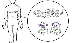 Stage IV Melanoma Cancer Treatment Options Explained Immunotherapy and Targeted Therapy [upl. by Begga]