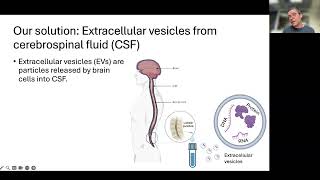 Dr Michael Flower UCL Institute of Neurology London [upl. by Kemble]