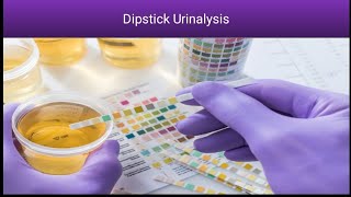 Dipstick Urinalysis Know about complete Dipstick Urinalysis  Rapid Urine Test [upl. by Ciryl513]