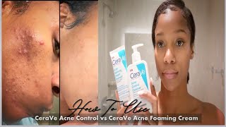 How to use✨ CeraVe Acne Control Cleanser vs CeraVe Acne Foaming Cream Cleanser 🙌🏾 30 Day Review [upl. by Iclehc]