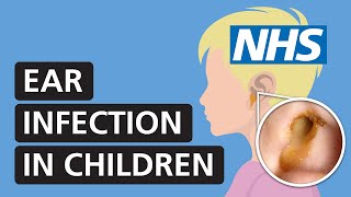 Ear infection in children symptoms and treatment  NHS [upl. by Hershel]