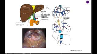 15 4 SEGMENTATION HÉPATIQUE [upl. by Yarod]