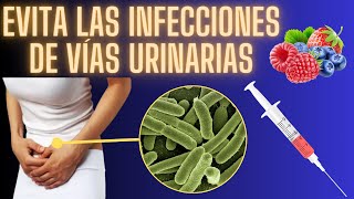 ¿Cómo evitar las infecciones de vías urinarias para siempre [upl. by Nodla]