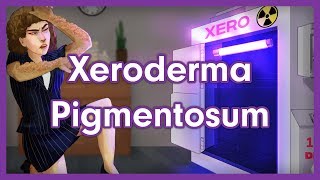 Xeroderma Pigmentosum Mnemonic for USMLE [upl. by Omar]