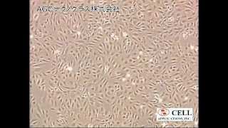 Human Umbilical Vein Endothelial Cells HUVEC [upl. by Yoj]