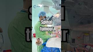 Spine tumour treatment  Cancer of spine treatment  Neurosurgeon [upl. by Jesse]