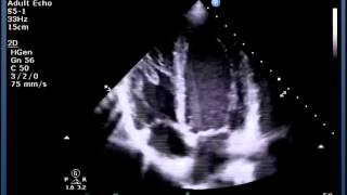 Understanding Echo Standard Imaging Views [upl. by Ecyrb]