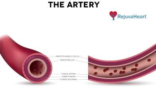 Vascular Endothelium Improvement from RejuvaHeart™ Therapy [upl. by Ayanaj703]