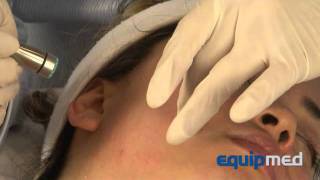 DermaSweep Training Video [upl. by Eisoj]