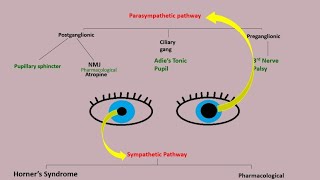 Anisocoria  evaluation of anisocoria  examination part 1 Approach to Anisocoria algorithm [upl. by Cia]