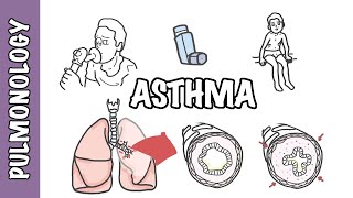 Understanding Asthma  pathophysiology and treatment [upl. by Carmencita]