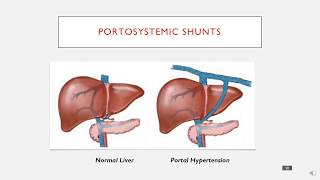 Portosystemic Shunts in 3 minutes [upl. by Fadil948]