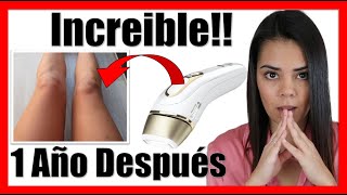 💆 Depilación IPL en CASA 💆 Braun silk expert pro 5 EXPERIENCIA eliminación vello 1 AÑO después [upl. by Endo]