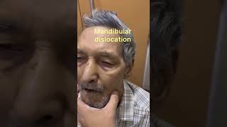 Temporomandibular TMJJoint Dislocation Reduction Technique Mandibular dislocationJaw dislocation [upl. by Aleahcim]