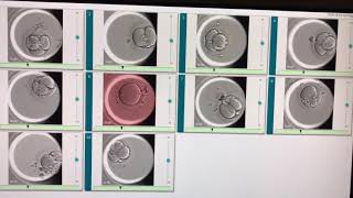 Embryoscope Development of the Embryos  IVF Turkey Clinics [upl. by Calloway]