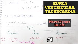 SupraVentricular tachycardia  Arrythmia in ECG  Cardiac arrythmia in hindi [upl. by Leander]