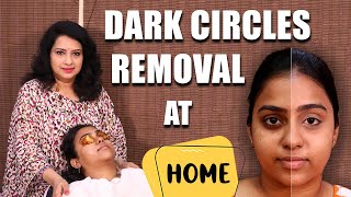 Remove Dark Circles Permanently  100 Natural Home Remedy  Vasundhara Tips  Say Swag [upl. by Analihp]