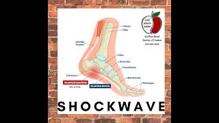 Stamford  Norwalk  New Canaan Shockwave for Plantar Fasciitis [upl. by Oidualc]