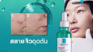 Effaclar Serum สลายได้ใน 2 สัปดาห์ [upl. by Nivi]