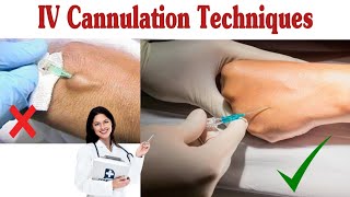 How To Insert IV Cannula  IV Cannulation Techniques [upl. by Vinita478]