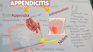 APPENDICITIS  BSC NURSING CAUSES PATHOPHYSIOLOGY SIGN AND SYMPTOMS MANAGEMENT [upl. by Enahpad]