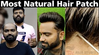 Most Natural Hair Patch For Men In India  Undetectable Hair Replacement Results [upl. by Ling]