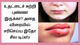 How to Get Rid of Dry Chapped Lips in tamil  Chapped Lips Remedy │Tamil Dear [upl. by Leyla]