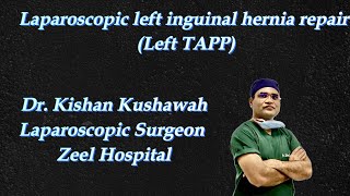 Laparoscopic left inguinal hernia repair with 3D mesh Left TAPP [upl. by Llerrom]